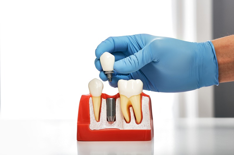 What Makes Expert Dentistry Stand Out in Quality of Care?